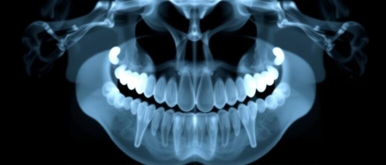 Рентгенология в стоматологии: цифровые атласы снимков и их роль в современной практике