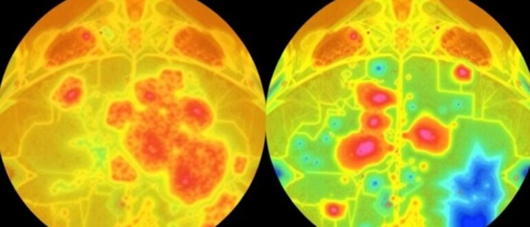 Дерматовенерология: электронные атласы сыпи и поражений кожи — цифровая карта клинической практики